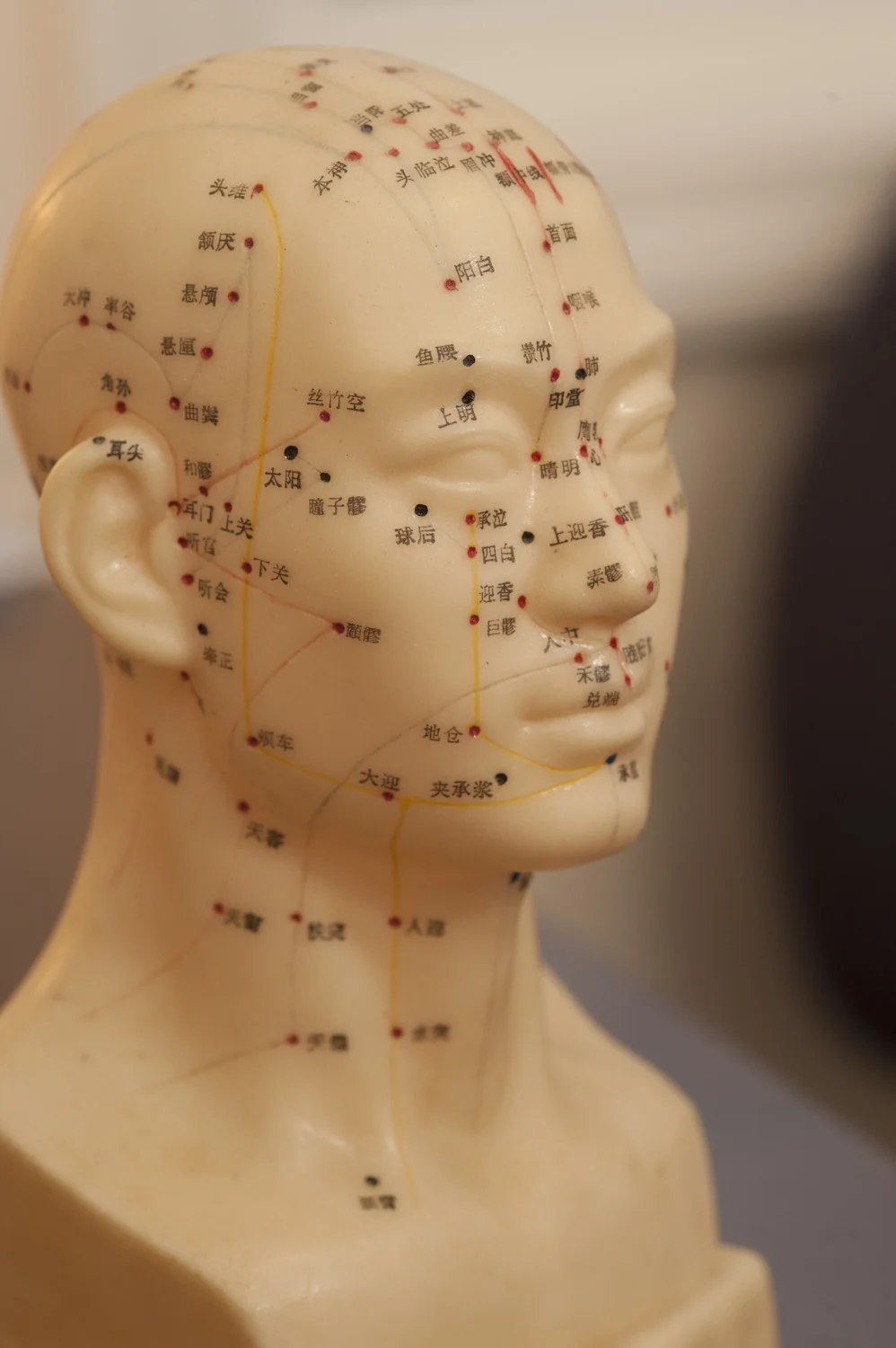 Nancy Graham, of Spring Lotus, in Rhode Island, examines a patient before performing acupuncture