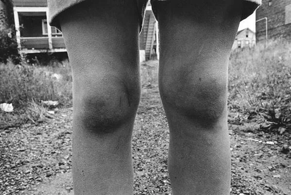 Dark knees, 1974