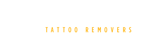 Invisible Ink Tattoo Removers in Pittsburgh, Minneapolis and Richmond. New Picosure Laser tattoo removal.
