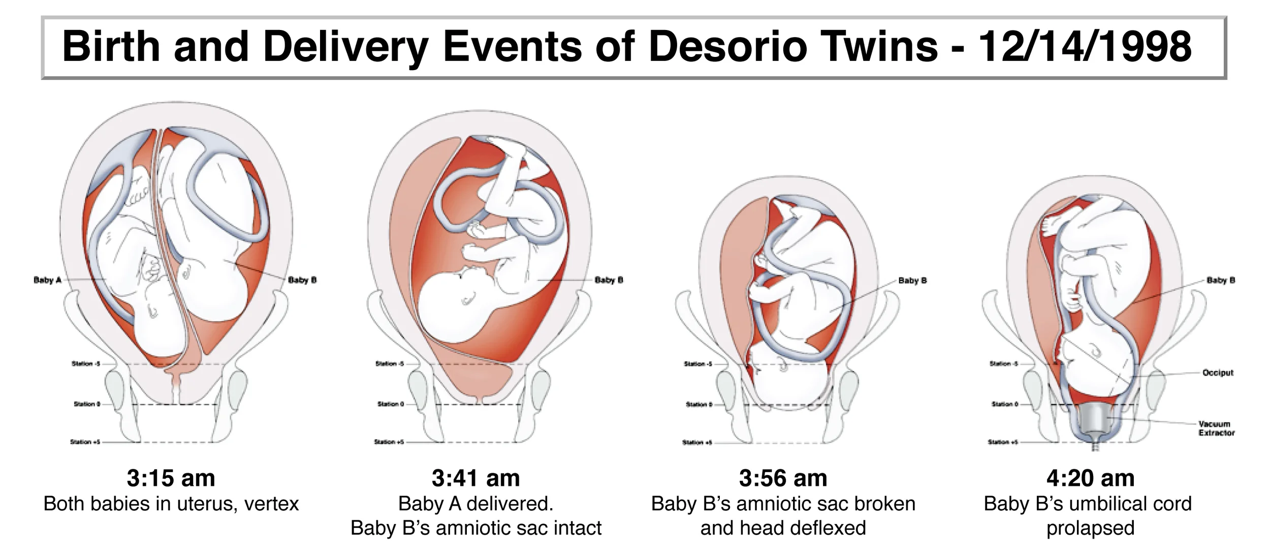 Baby Exhibit.jpg