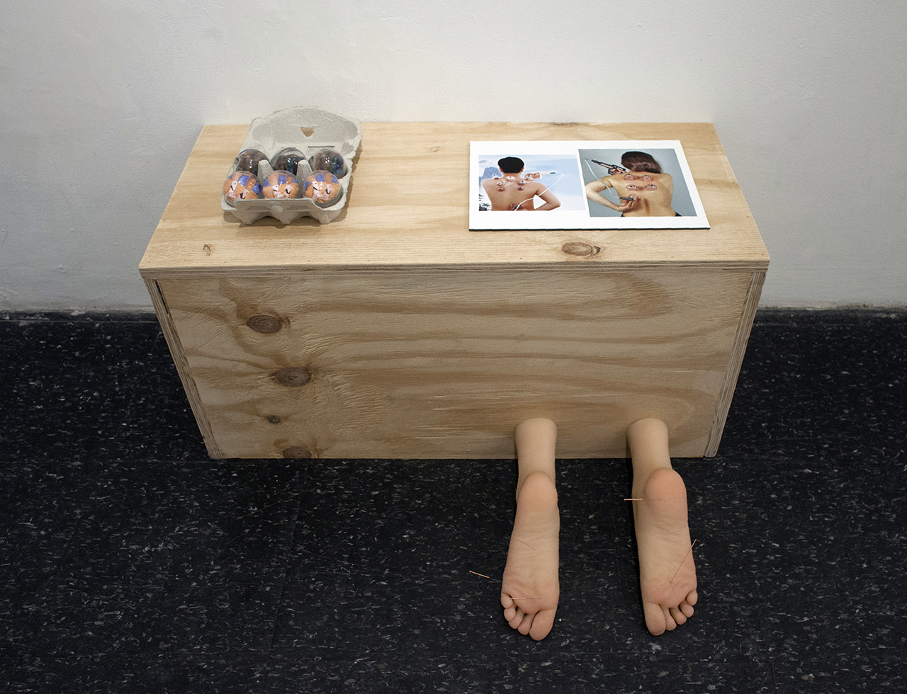 Maryam Jafri. Depression (2017). 29.5" x 14.5" x 24.25". wood, silicone feet, acupuncture needles, glass cupping equipment, photograph, paper, egg carton