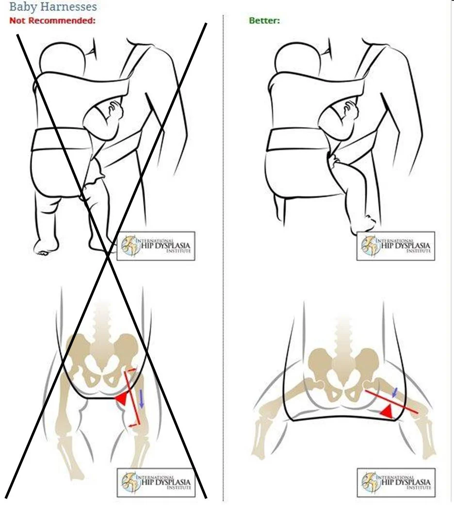 http://www.hipdysplasia.org/