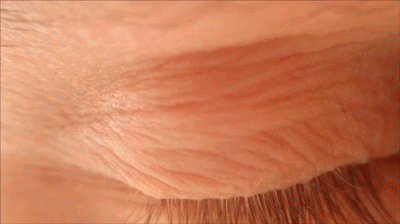 Meredith - The blind psychotherapist