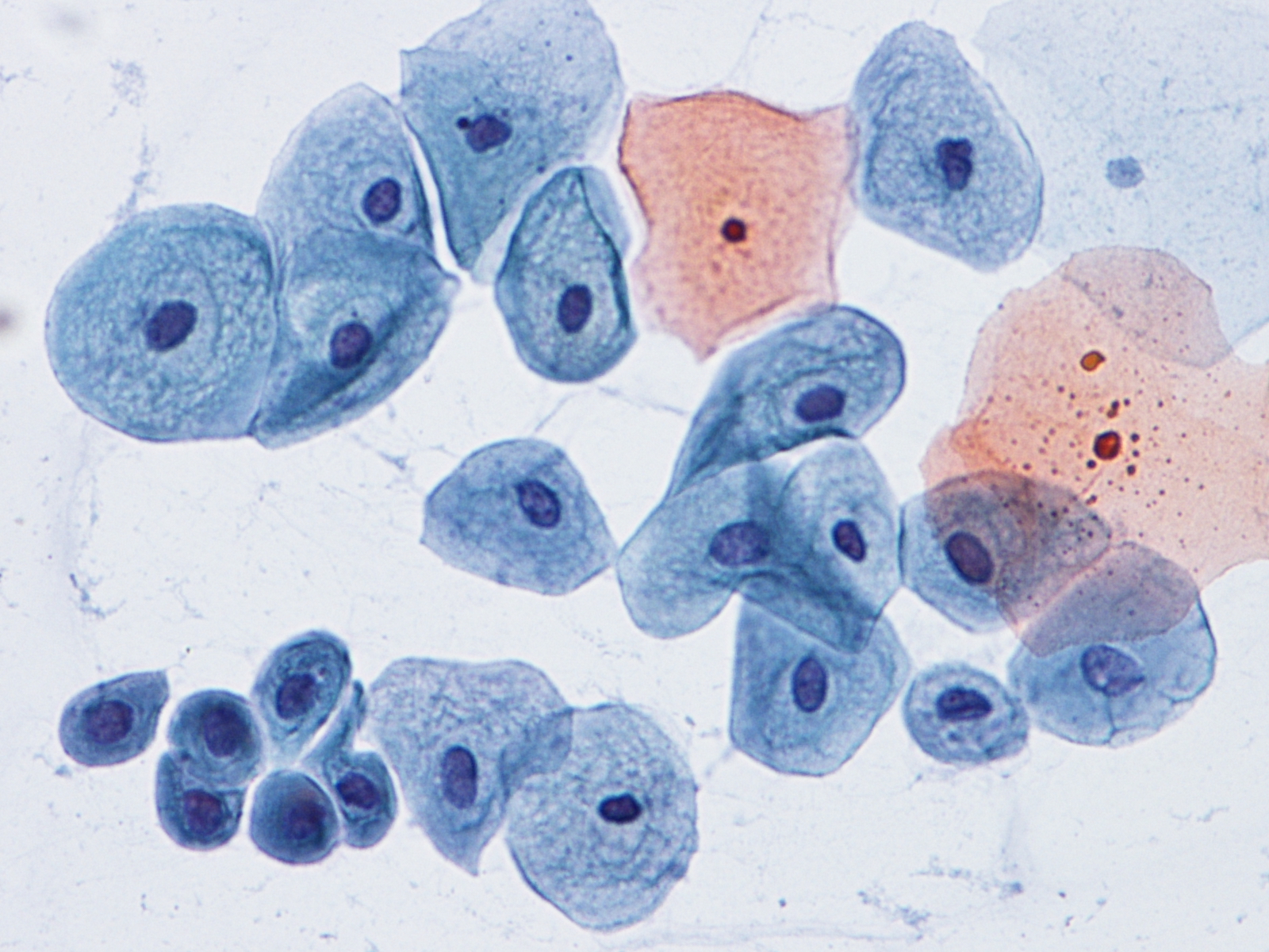 01-cervice-cell_normali-pav_interm_basali.jpg