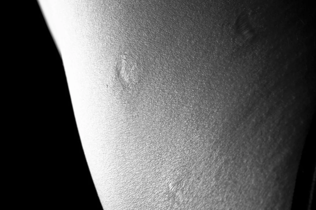 "You should have seen it. It looked like rice in there!"