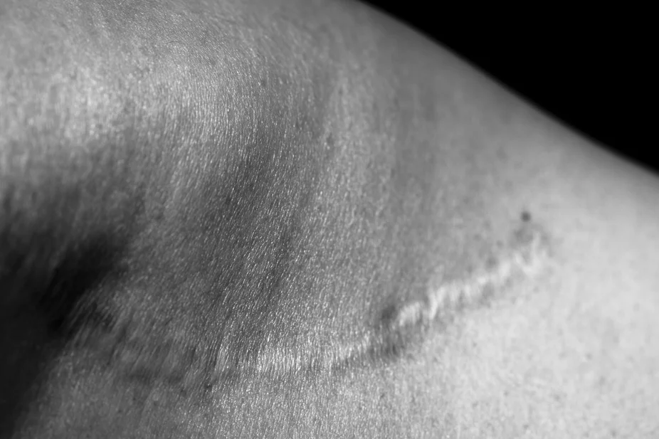 "Surgery was a transformative experience."