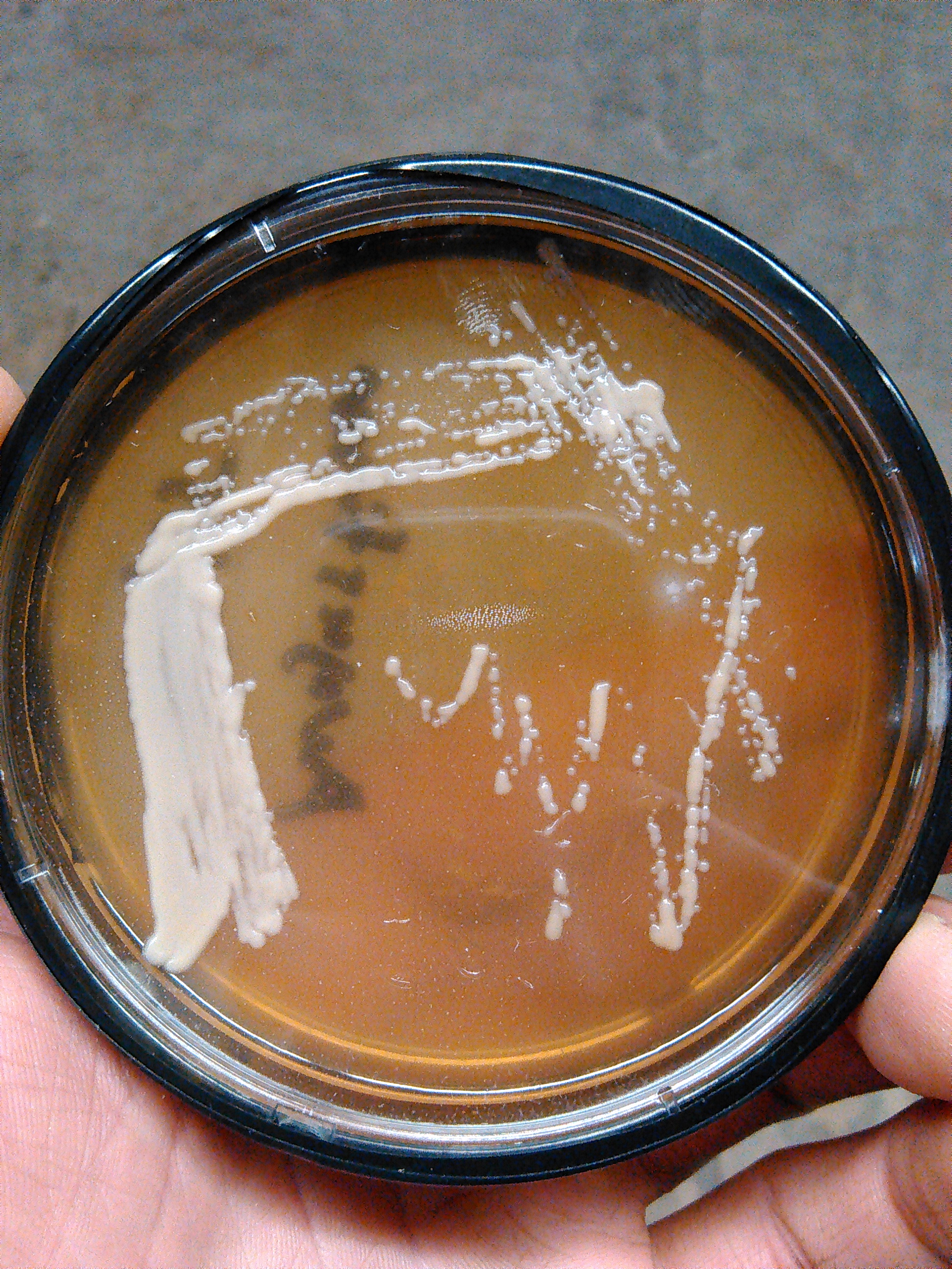A pure culture of yeast plated out and stored. This will stay viable for at least 3 months to a year and we can actually brew with this after propagation!