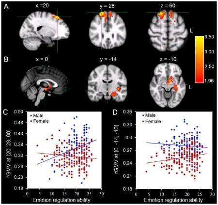 A: The right DLPFC, where the interaction between sex and emotion regulation ability was found. B: The anatomical cluster that encompasses to the left hippocampus, left amygdala, and insular cortex - where the interaction between sex and emotion regulation ability was found in females.