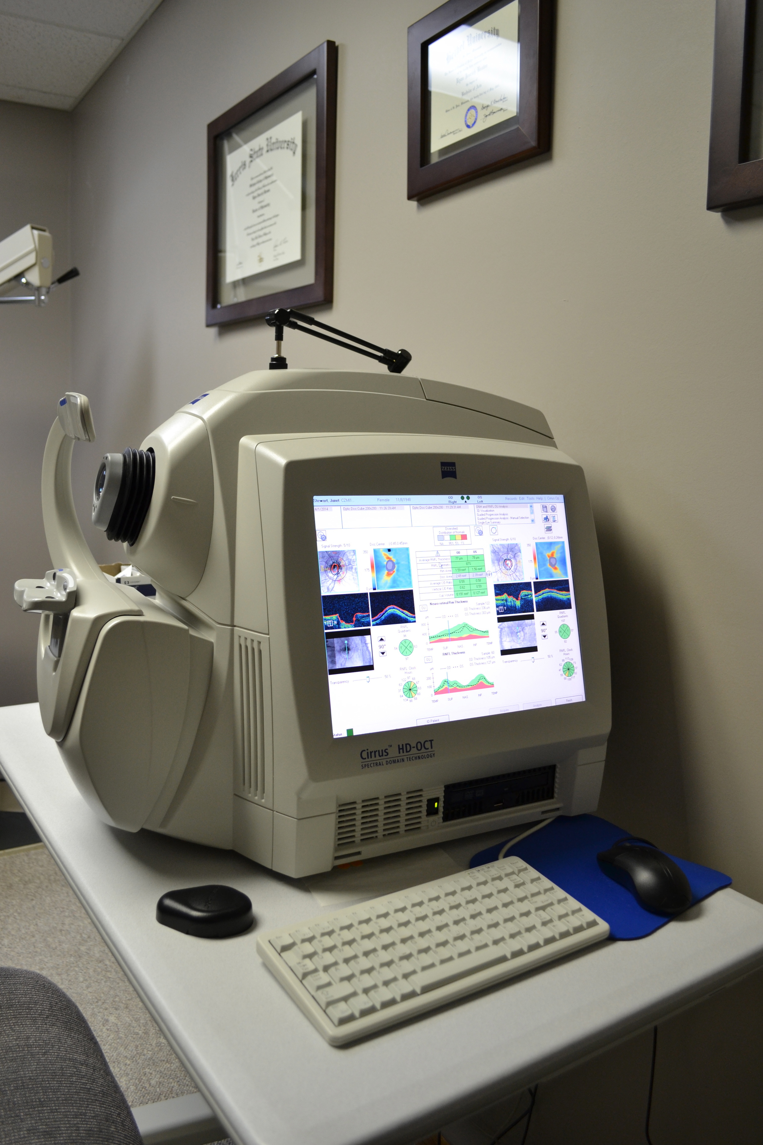 Zeiss Cirrus OCT retinal pathology management 