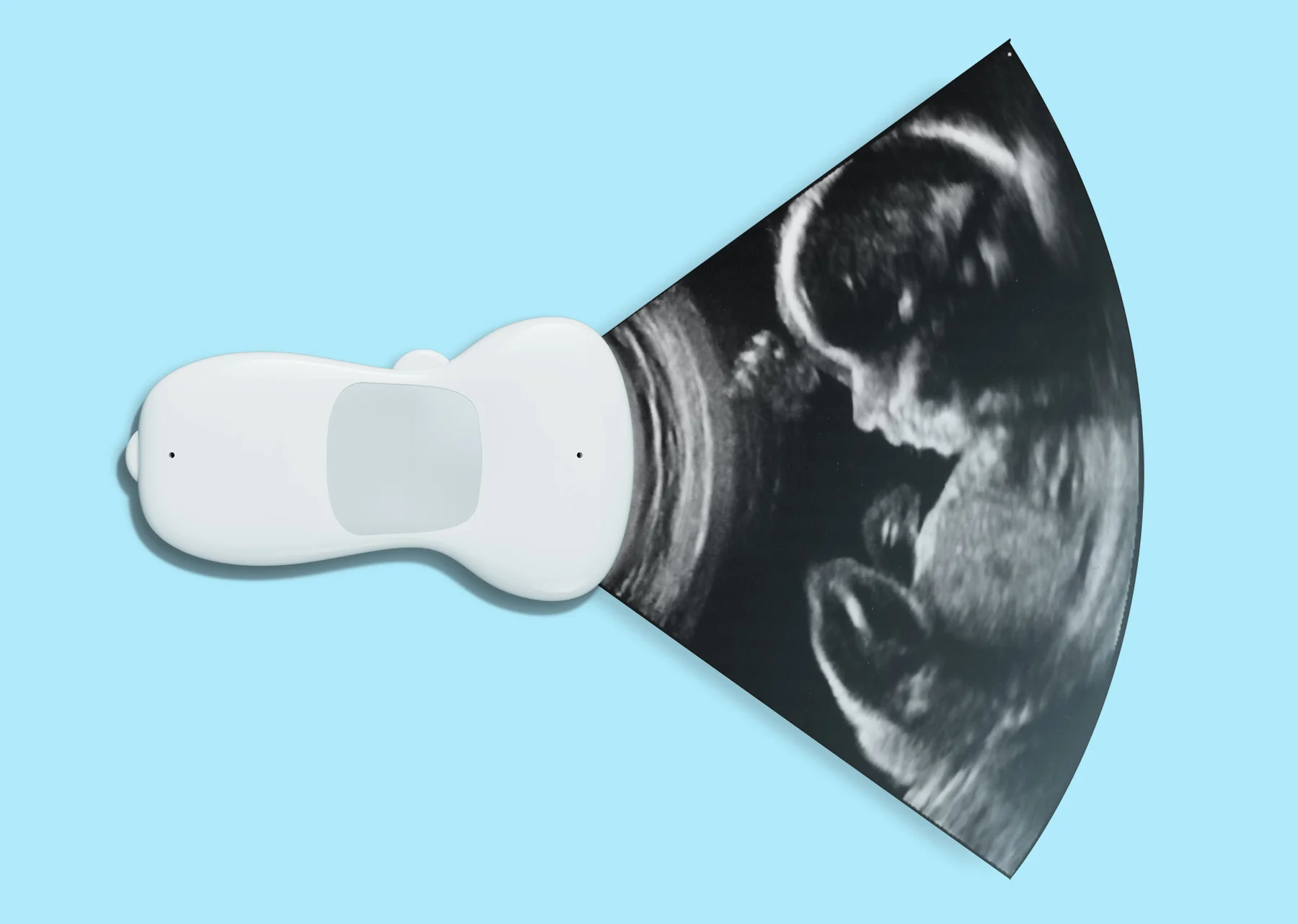 Ultrasound_Probe_with Image.jpg