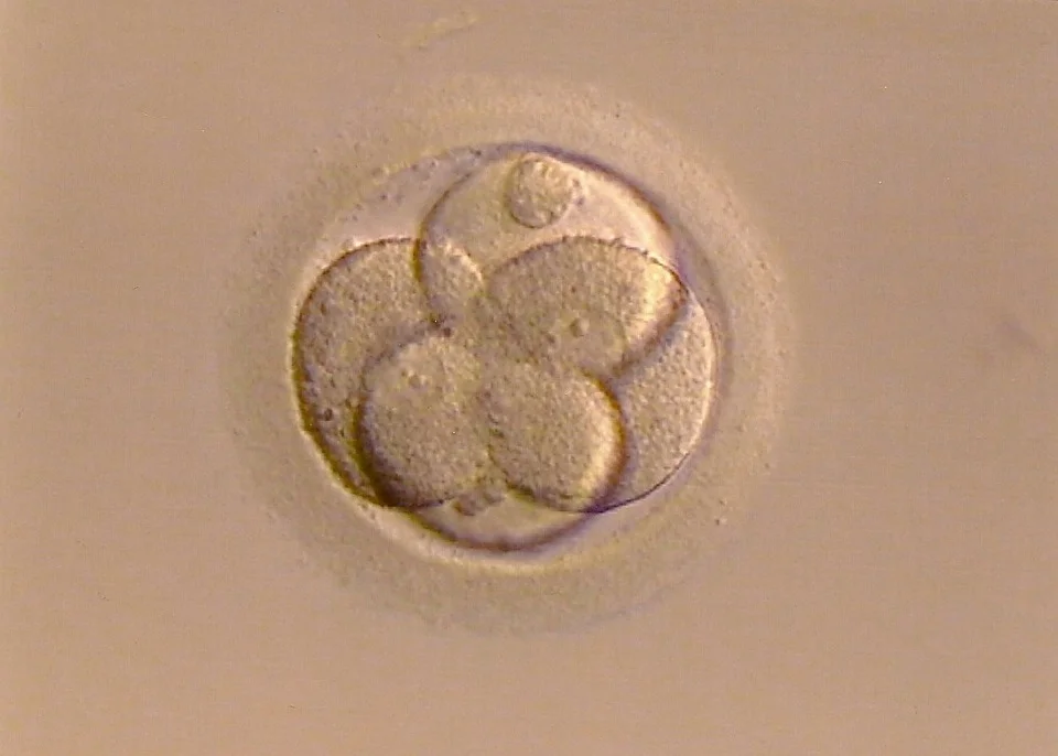 Recent Study Finds No Risk For Developmental Delay with IVF if no Twins