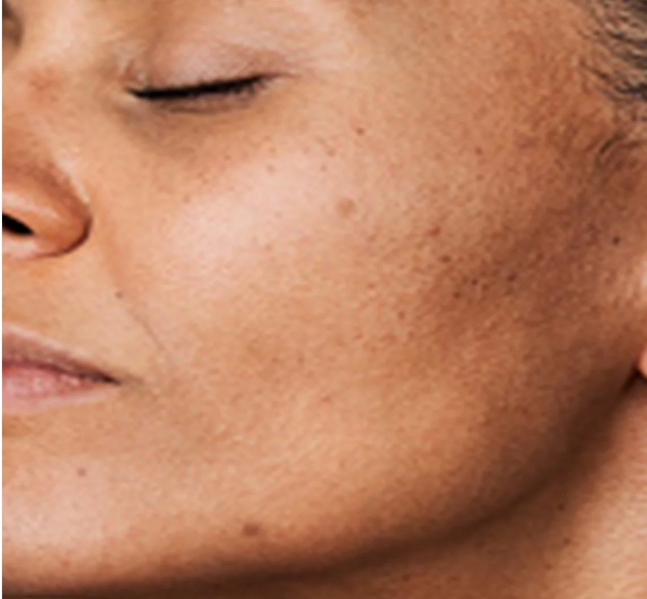 uneven tone