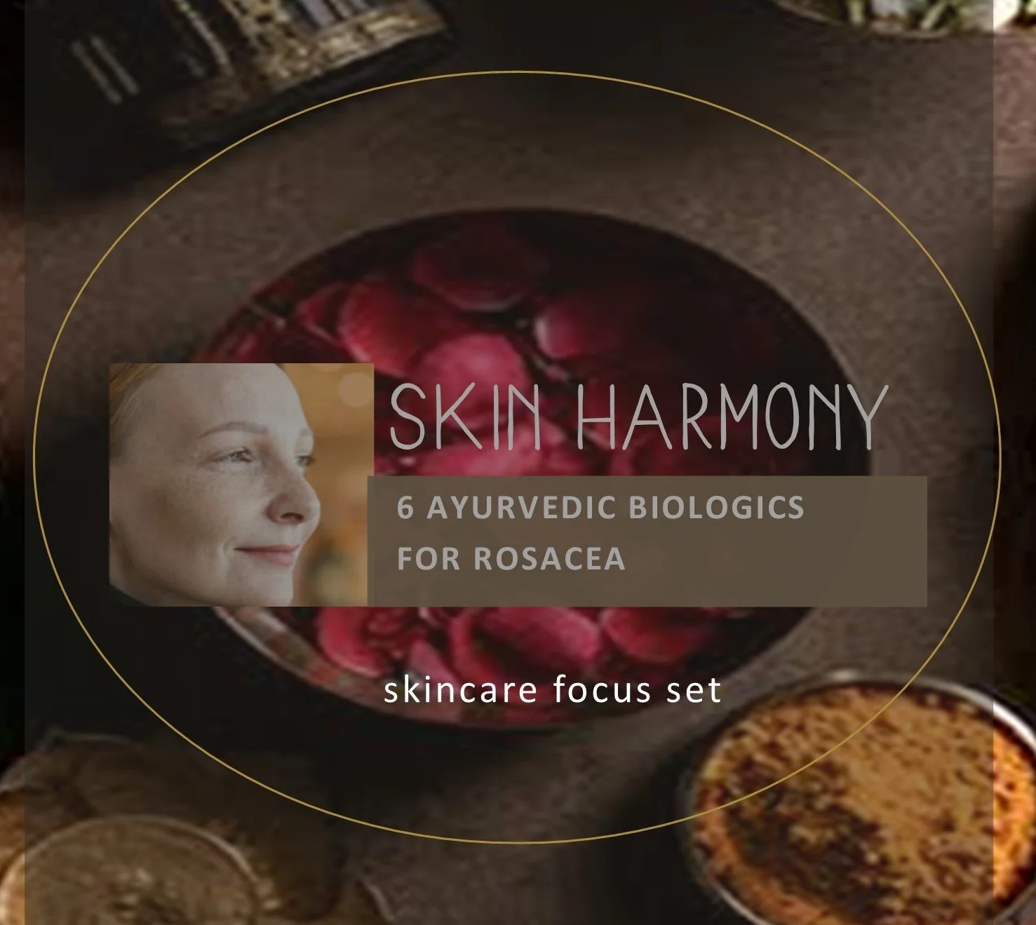 NST rosacea kit.jpg