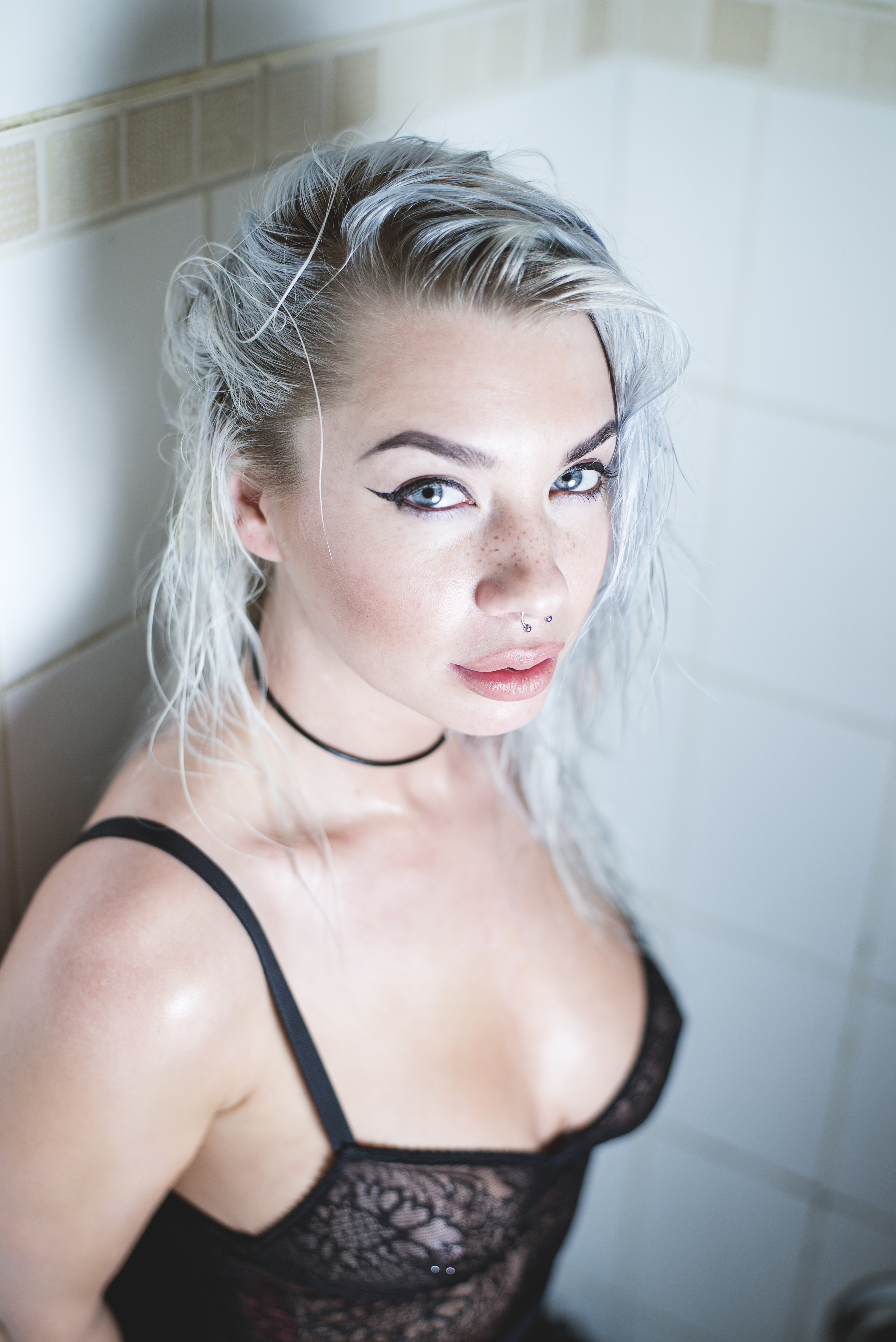 freckles
