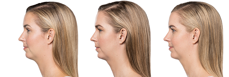 left-image (9).png