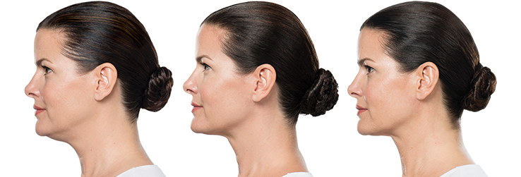 left-image (3).png