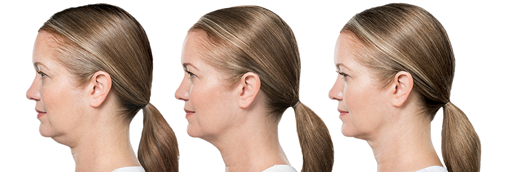 left-image (4).png