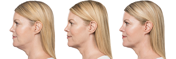 left-image (7).png