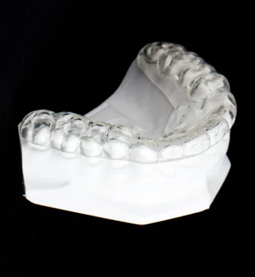 Custom Night Guard by Lorentzen Dental