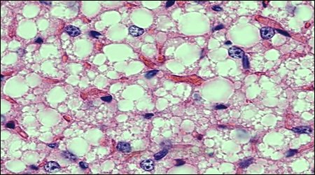 Brown adipose tissue up close