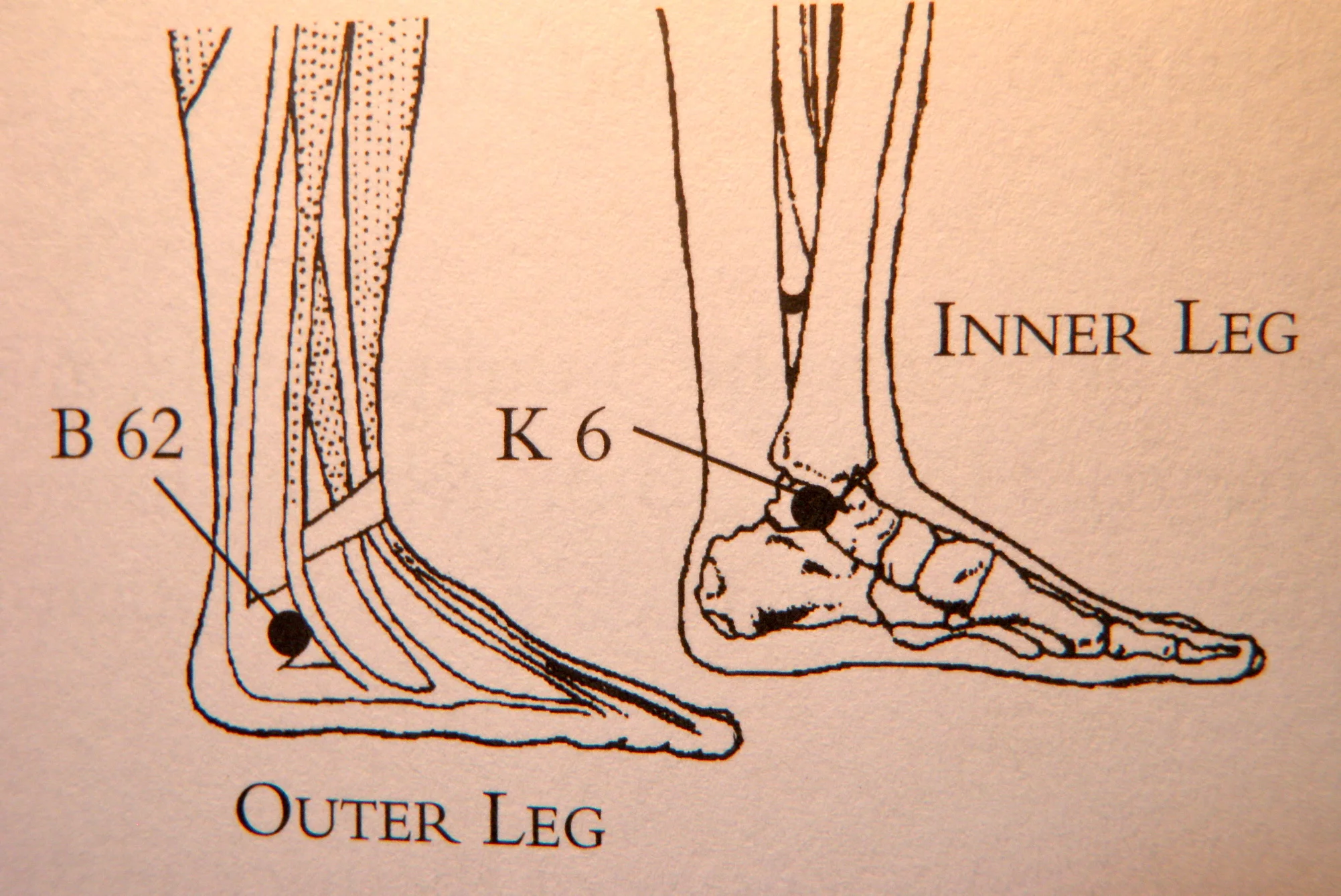sleepacupressure.jpg