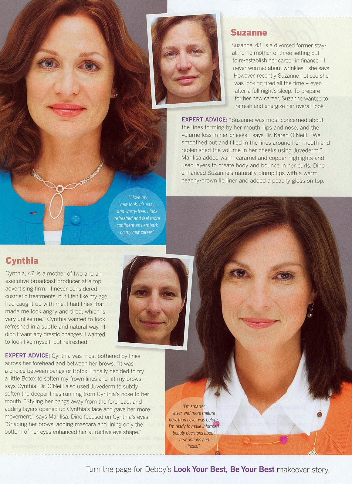 juvederm-ad_3_sm.jpg