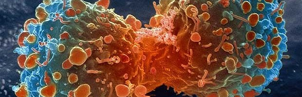 killing-cancer-2-620x336.jpg