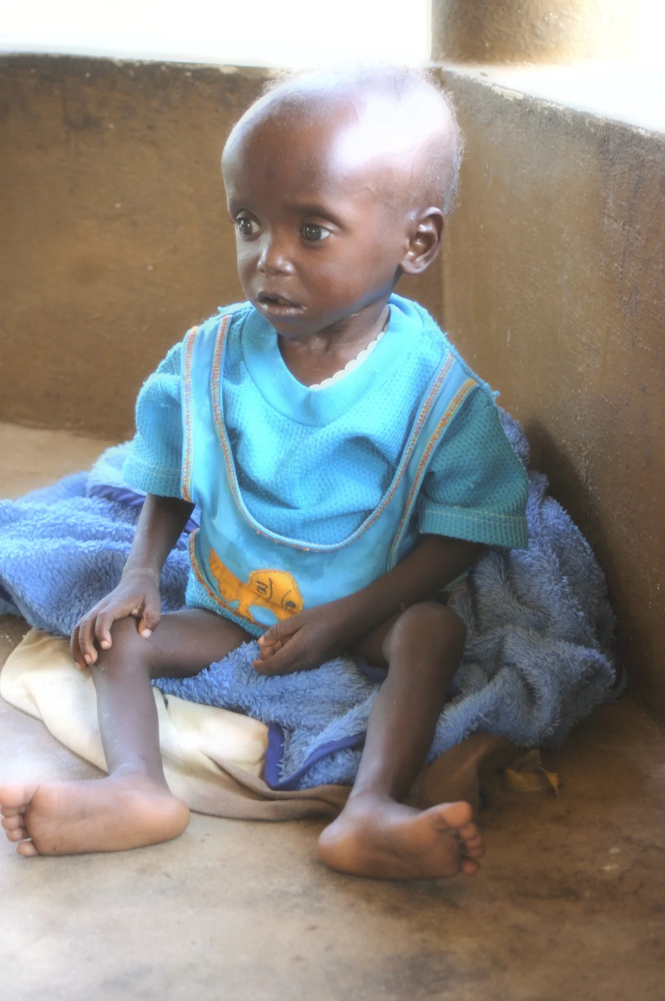 Worst Under 5 Mortality Rate
