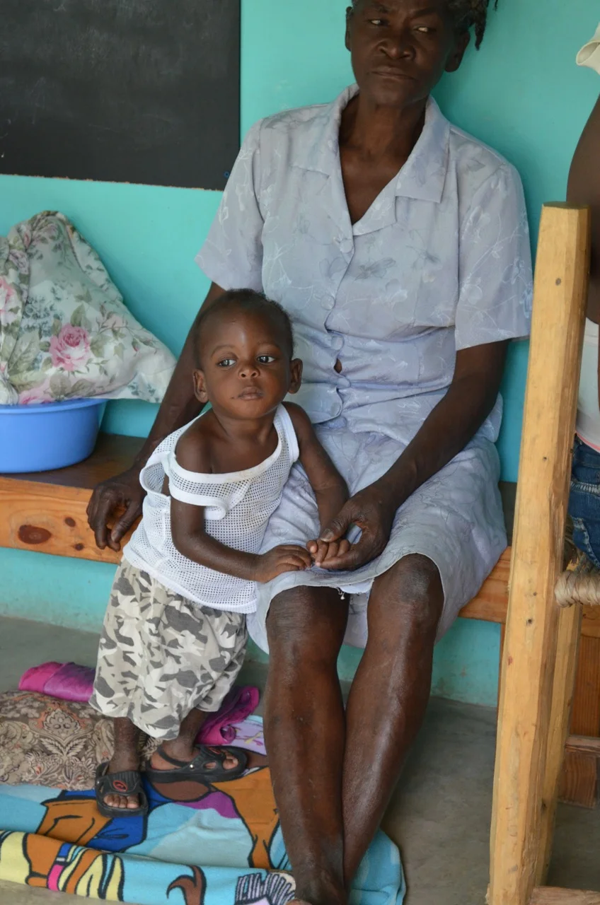 Admission to Second Mile after hospitalization at local hospital - 16 months - 17 lbs