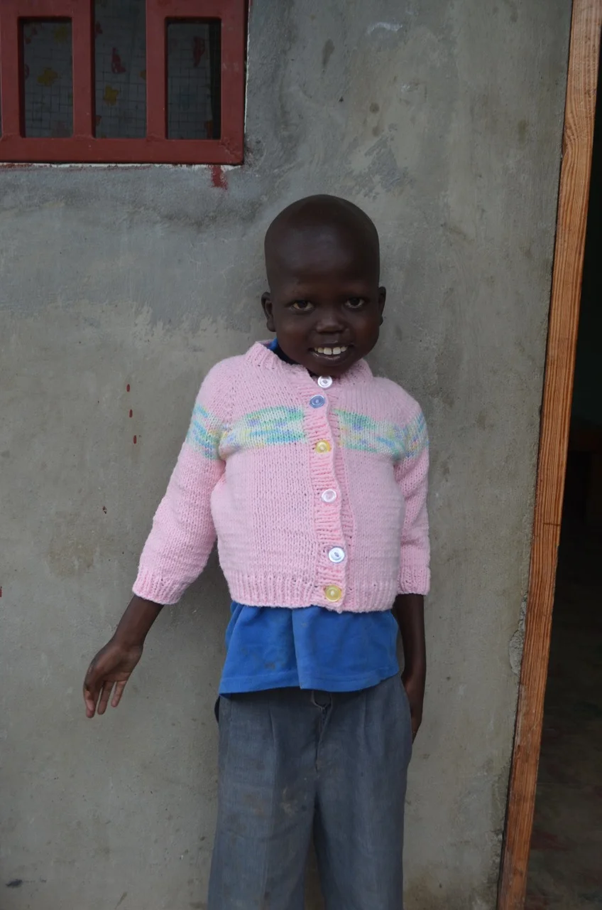 Kely, during his 3rd week of rehabilitation (Second Mile Haiti)