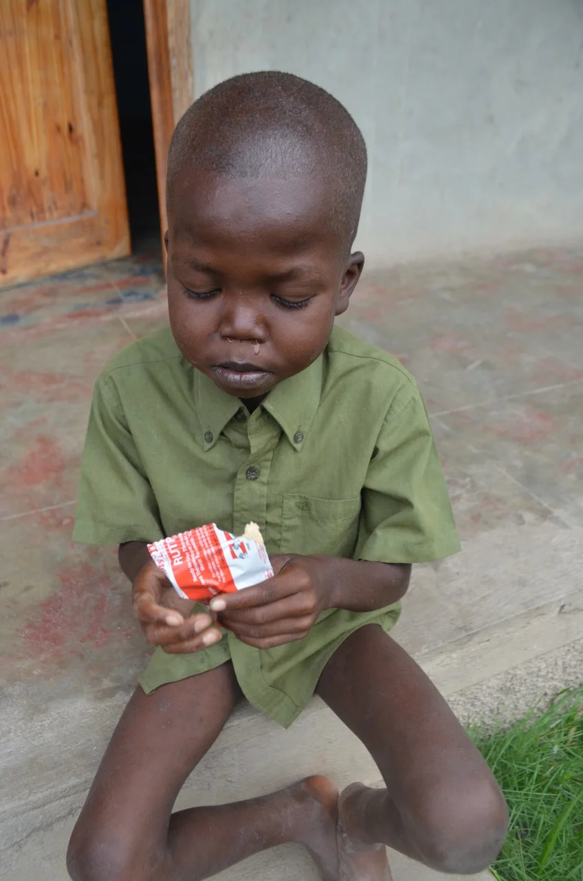 Kely with Medika Manba (RUTF) produced by Meds and Foods for Kids (Cap Haitien). Typical treatment 8-10 weeks.