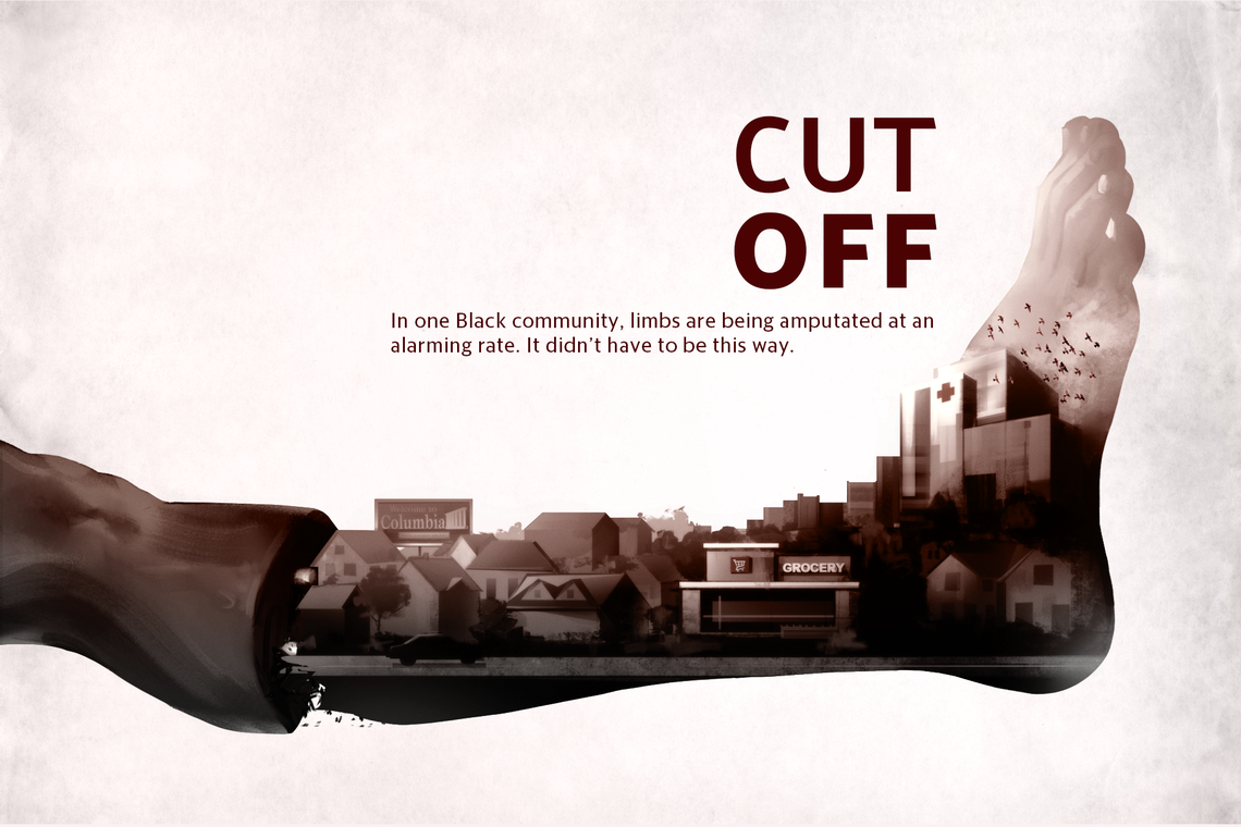 Cut_Off_Lead.png