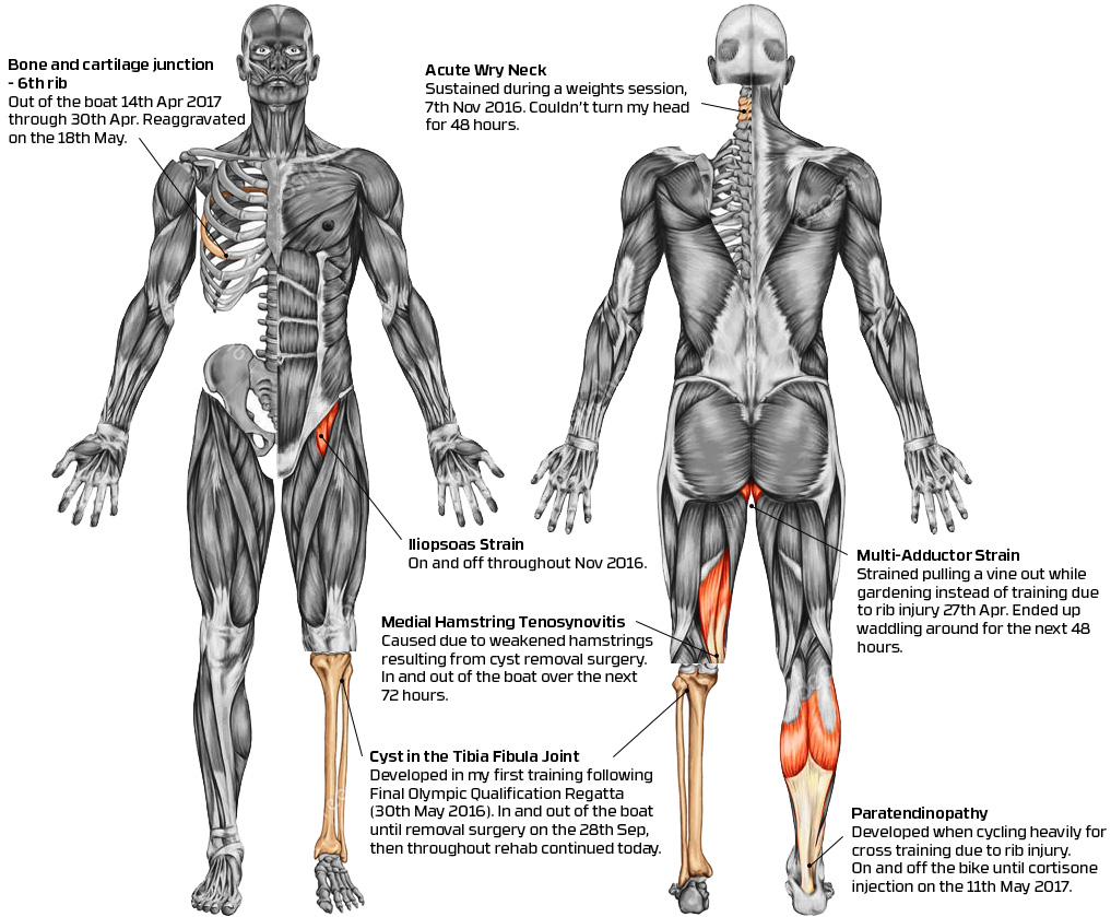 Injuries sustained over the last 12 months.