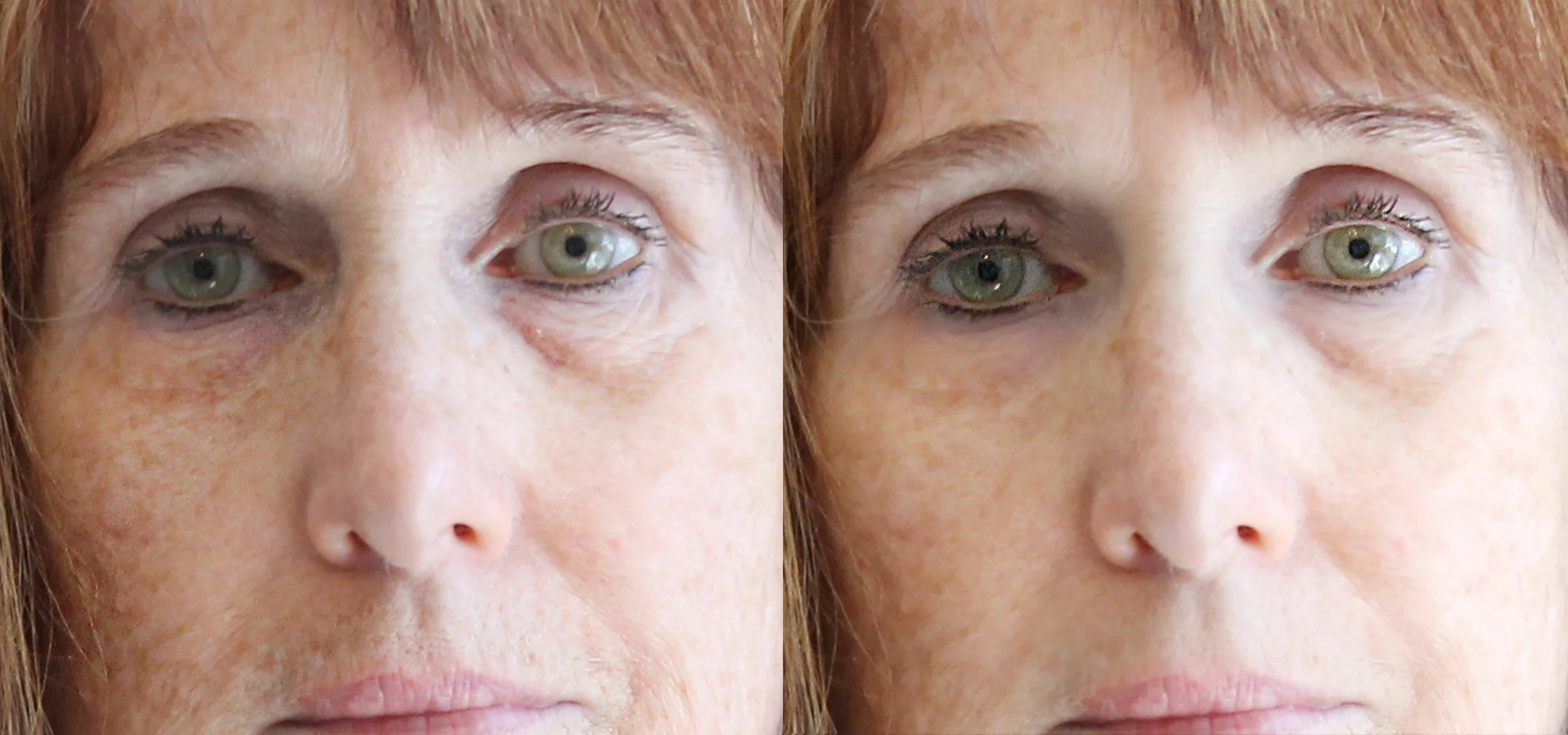 Illuminating Eye Repair