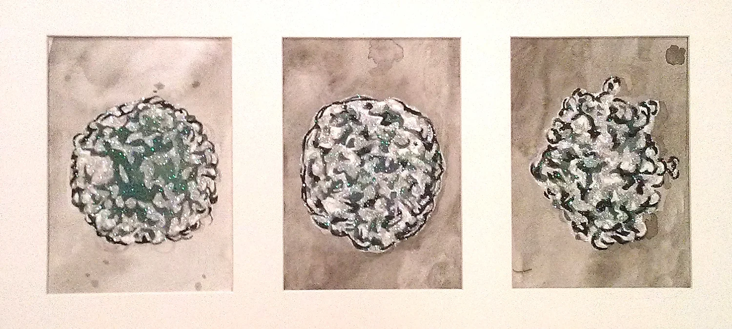 Tumor Cells, 2014