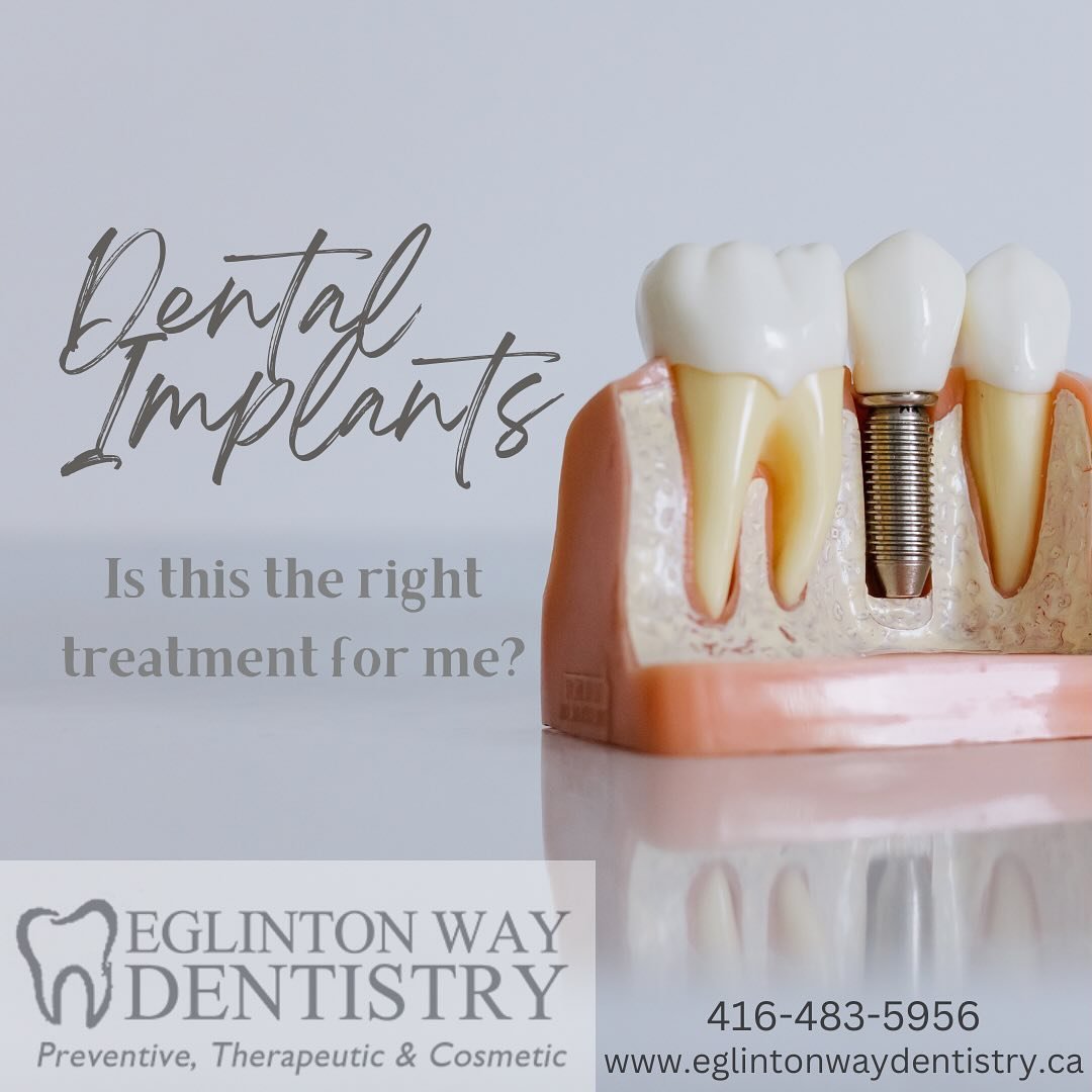 SWIPE ➡️ to see if dental implants may be the right treatment option for you 🦷

Still unsure? Call us today and we can book you in for your consultation with Dr. Elliott ✨

📞416-483-5956
💌smile@eglintonwaydentistry.ca

.
.
.
.
.
.

 #toptorontoden