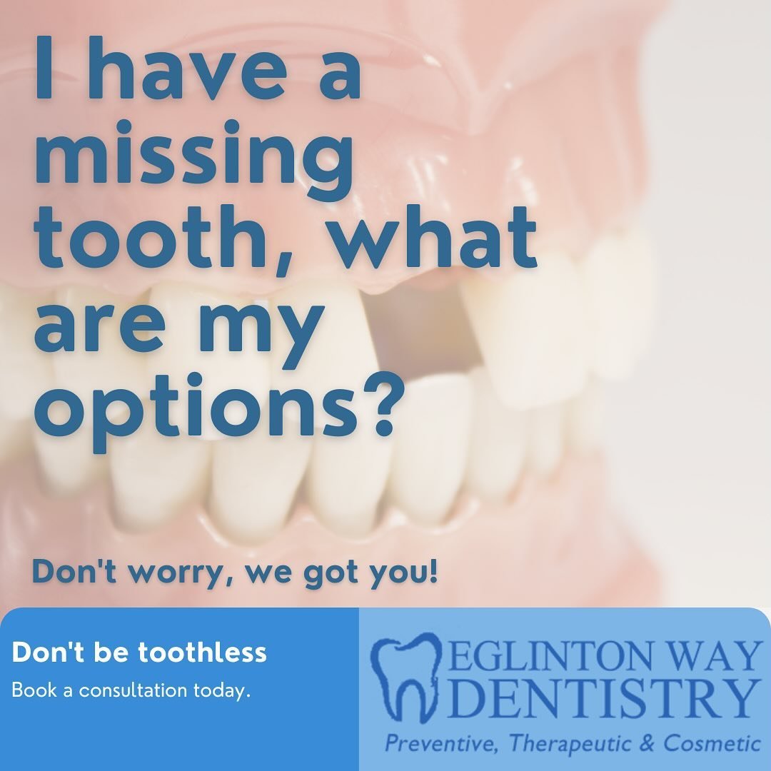 Options to replace a missing tooth: 

🦷Dental Implants

One of the most common methods to replace a missing tooth.
It is a very reliable type of tooth replacement that feels and looks
like a real tooth. If cared for properly, dental implants can las