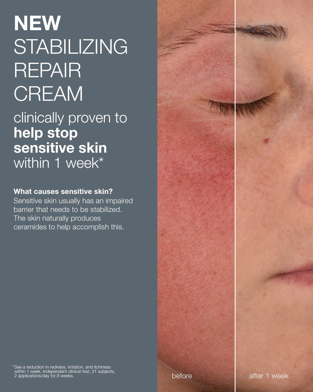 4x5 Stabilizing Repair Cream Clinical In feed Post.jpg