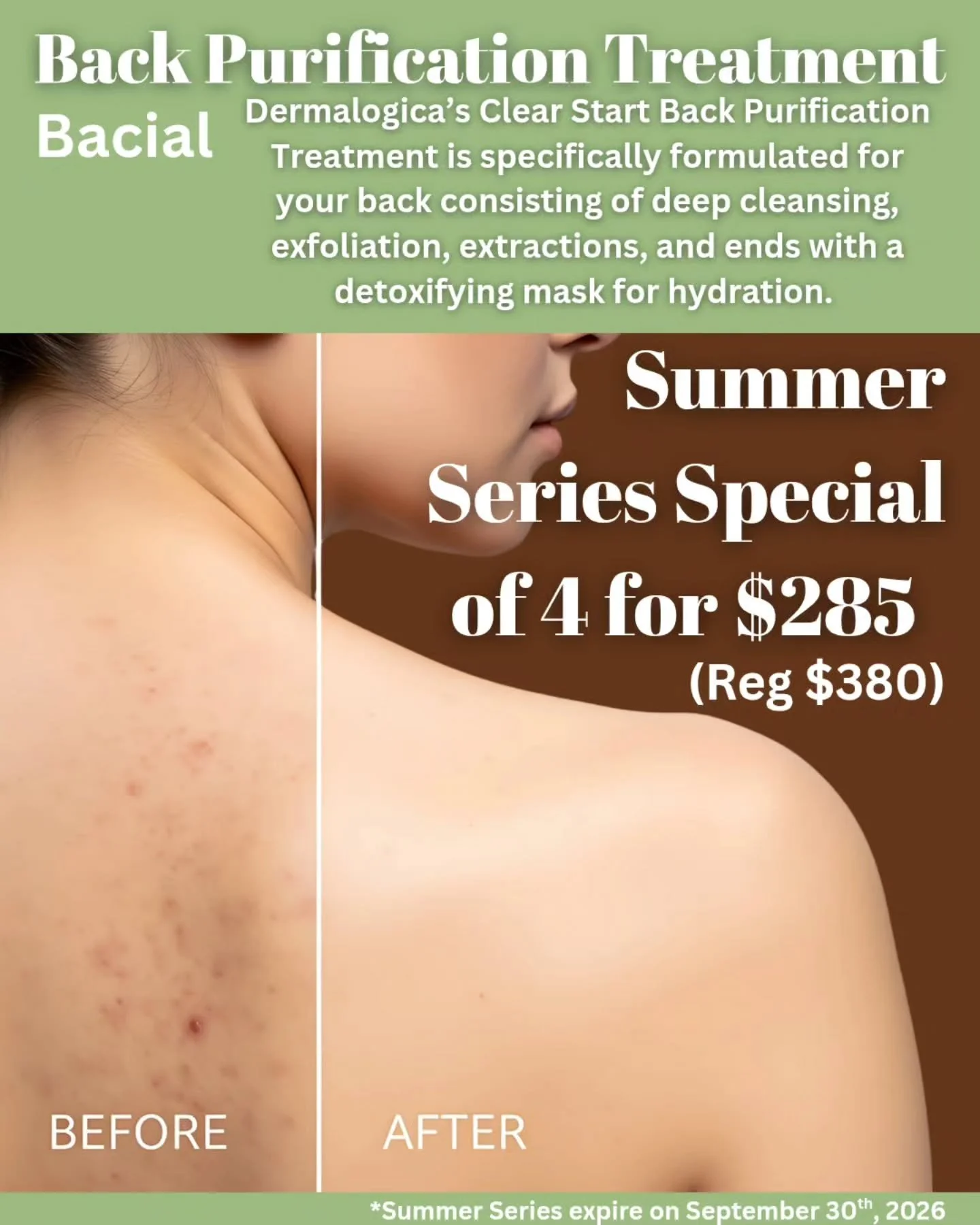 Buy a Summer Series of 4 Bacials for the price of 3. Let our Esthetician help you keep your back clear of breakouts with this treatment. 
Make your appointment today at 
https://balancehairspa.com/appointment-request

&nbsp;@clubpilates_exton @juicep