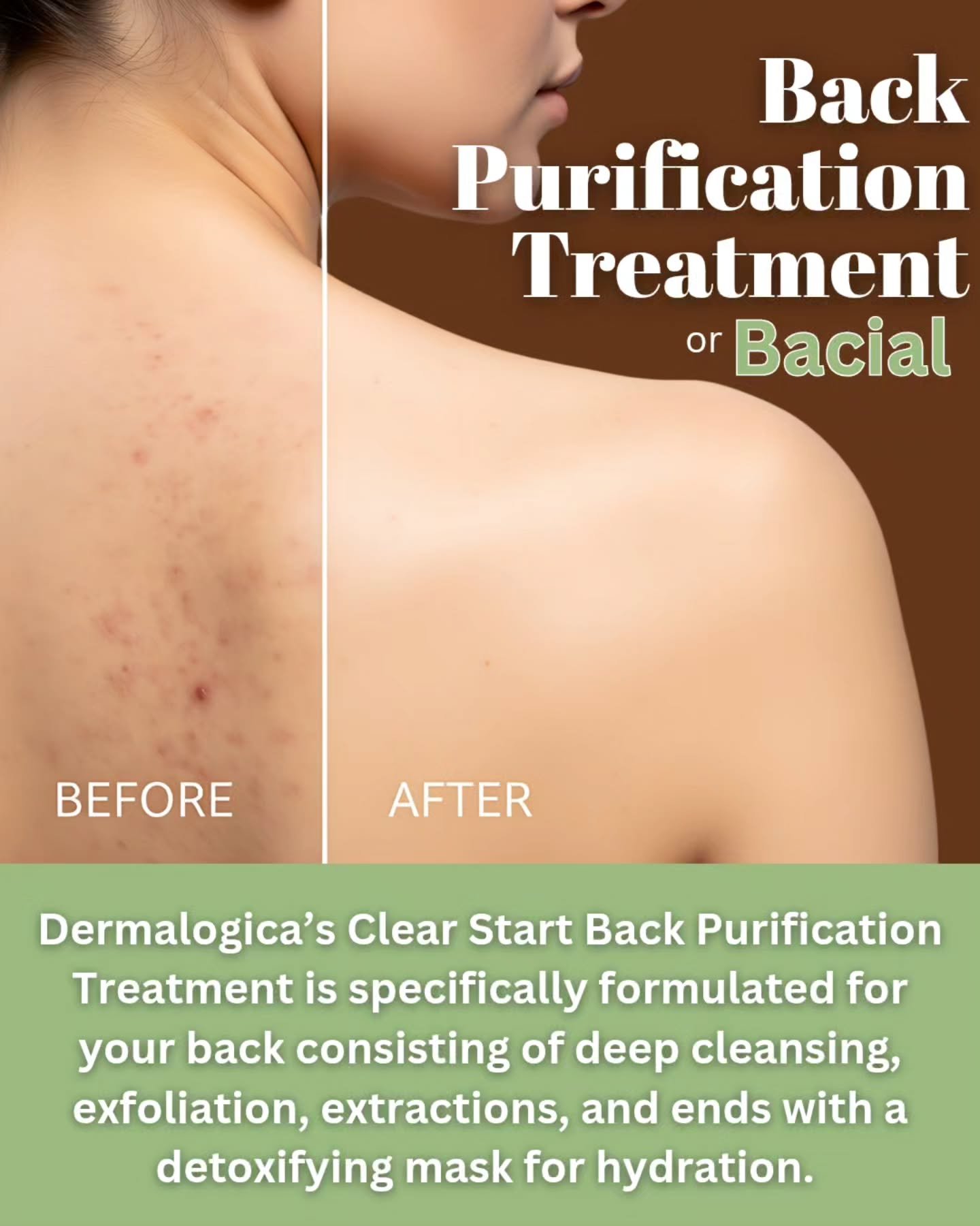 Do you get breakouts on your back? Treat yourself to a Bacial (back treatment)  Our Esthetician will cleans, exfoliate,  extract, and get you set up for clearer skin.  Make an appointment at
https://balancehairspa.com/appointment-request
&nbsp;@clubp