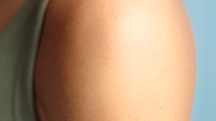 CETAPHIL