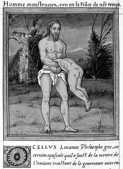 Scene from unaired Supernatural episode in which Sam and Dean encounter the terrifying "man-monster". Studio executives decided not to run the episode, citing "too many jokes about bottoms". 'Homme monstrueux, veu en la France de nostre temps' (Man monster who has been seen in France in our time), from the Histoires prodigieuses by Pierre Boaistuau, 1560 (folio 137, verso) . Wellcome Library, London, image no. L0025563.