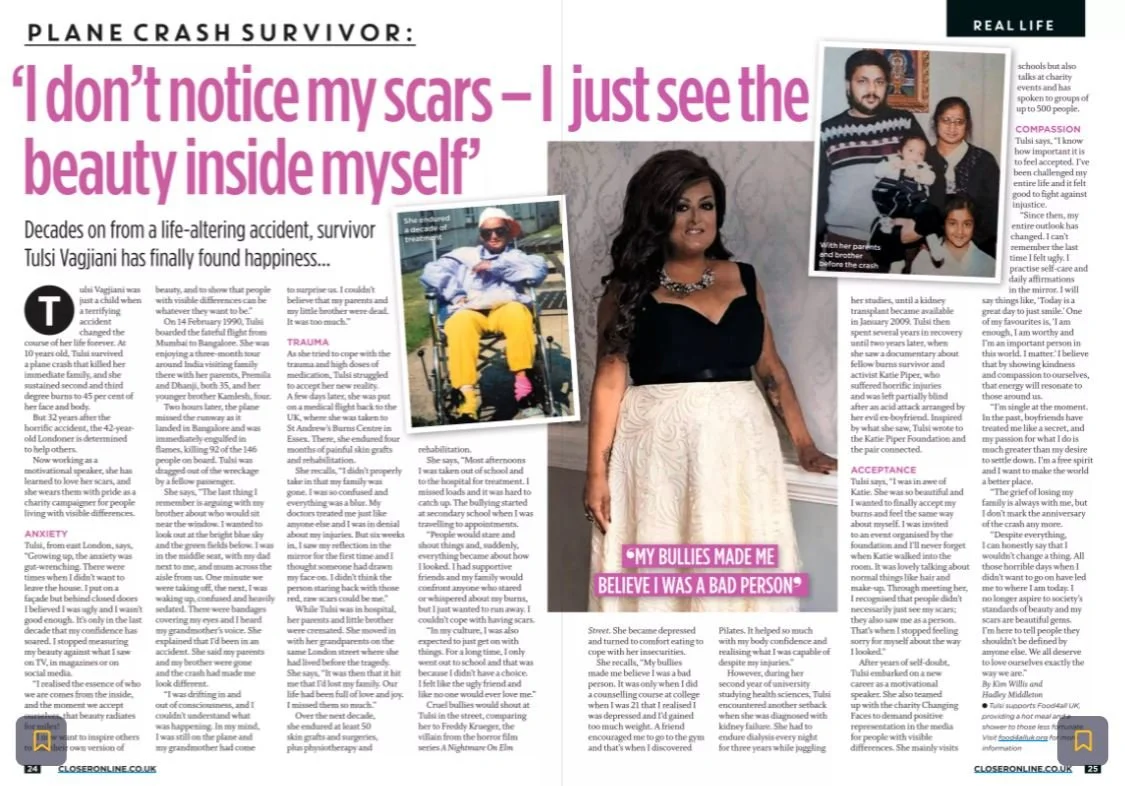 I don't notice my scars