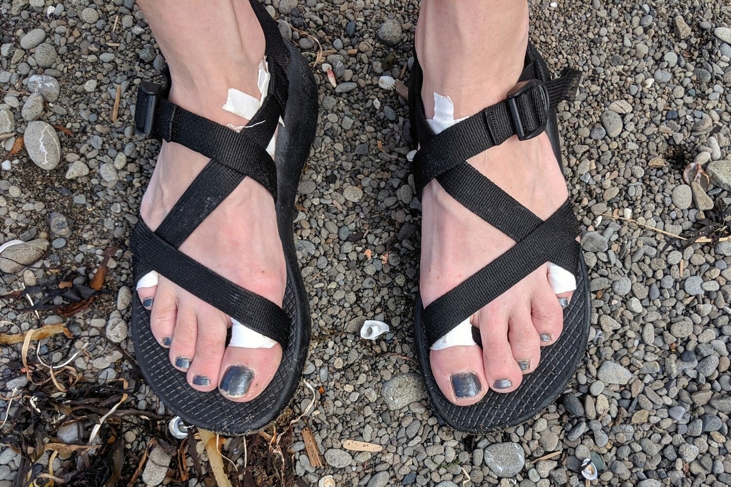 chaco toe strap hurts