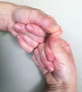 Pit_Reflex_Pic.jpg