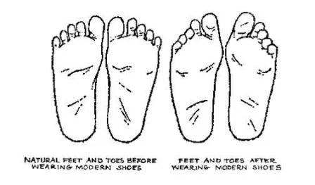 Foot Shape Change - sm.jpg