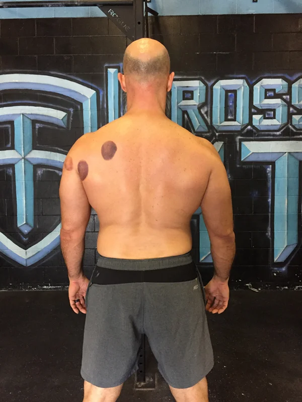 Acceptable Back Image