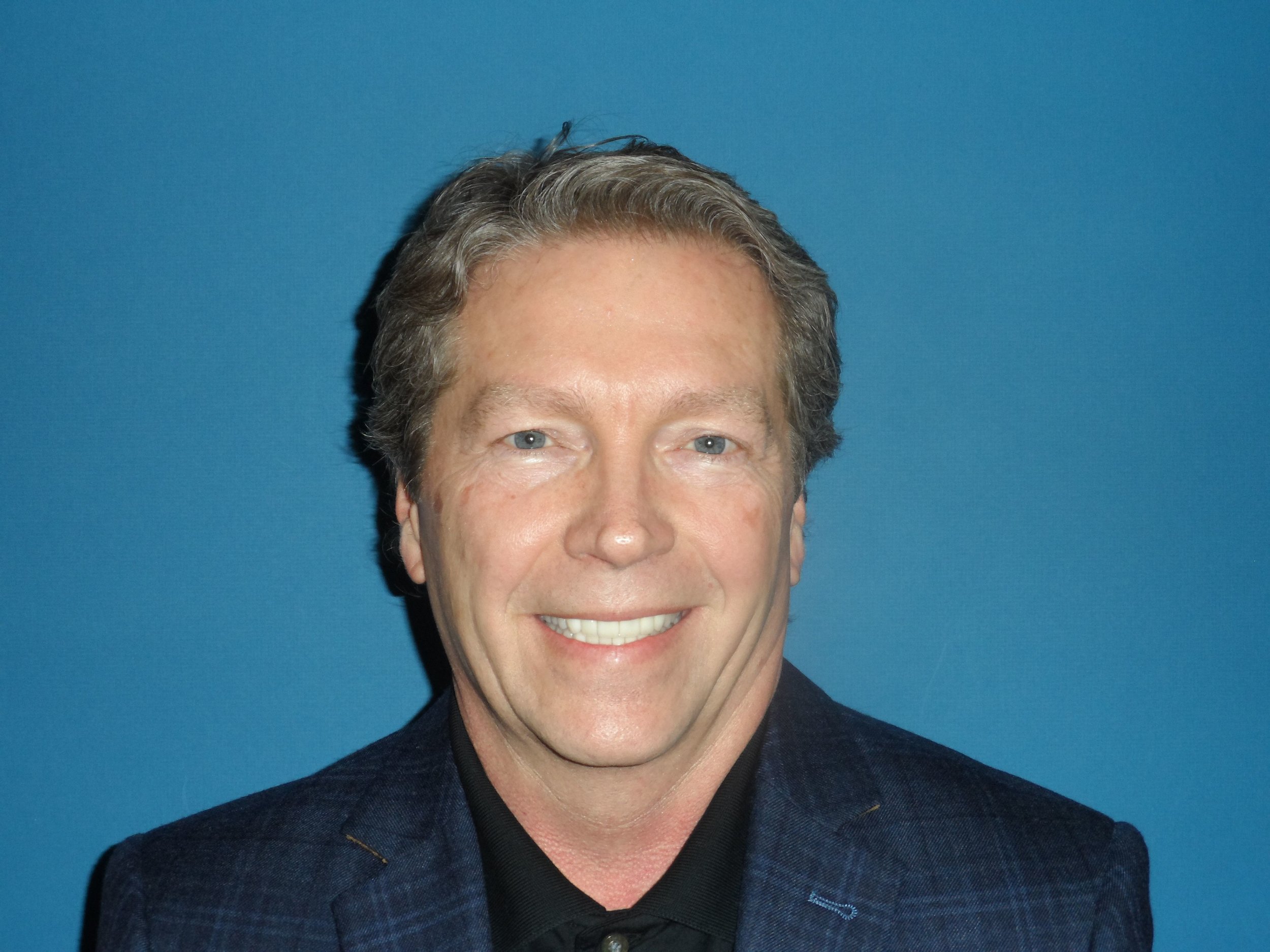 Dave After TMJ/Cosmetic Treatment