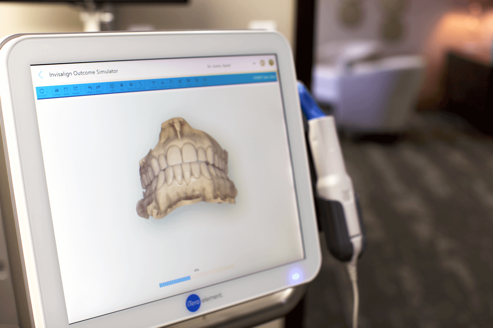 Invisalign outcome simulation available at Springfield Smile Doctor with iTero. Ask Dr. Green about your Invisalign animation.
