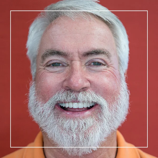 Copy of After Custom Porcelain Restorations